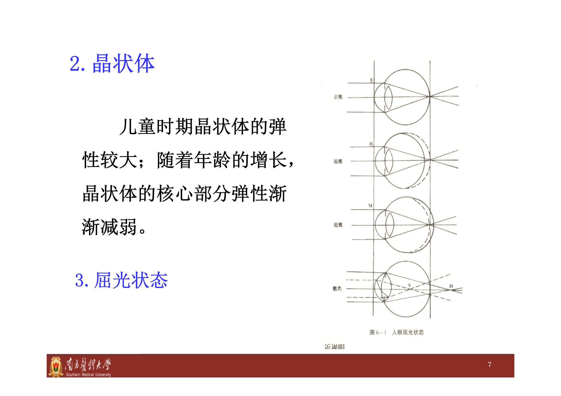 人眼屈光状态示意